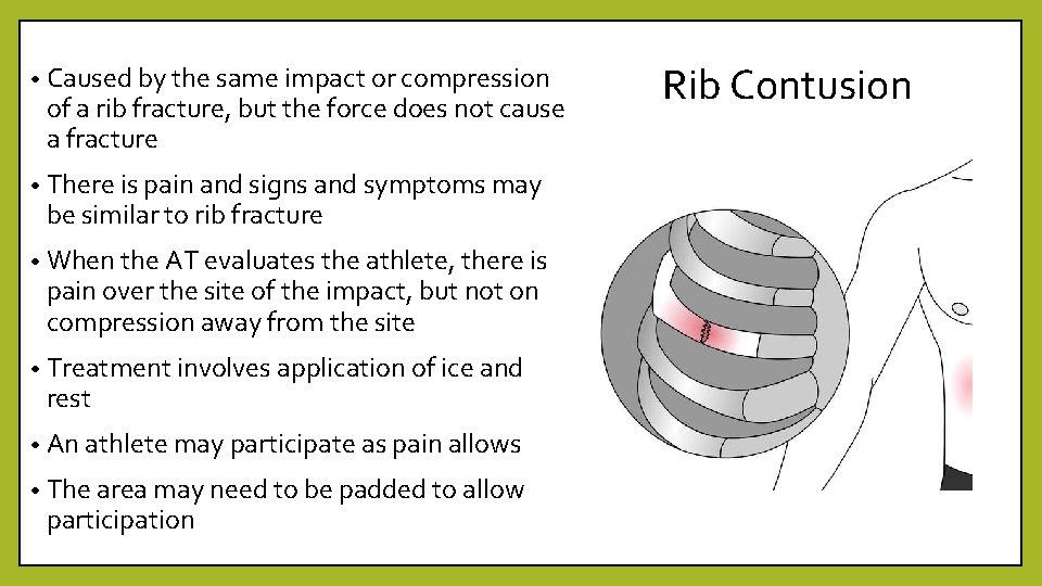  • Caused by the same impact or compression of a rib fracture, but