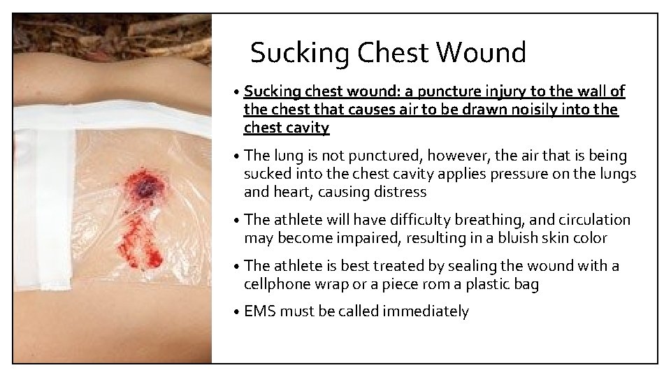 Sucking Chest Wound • Sucking chest wound: a puncture injury to the wall of