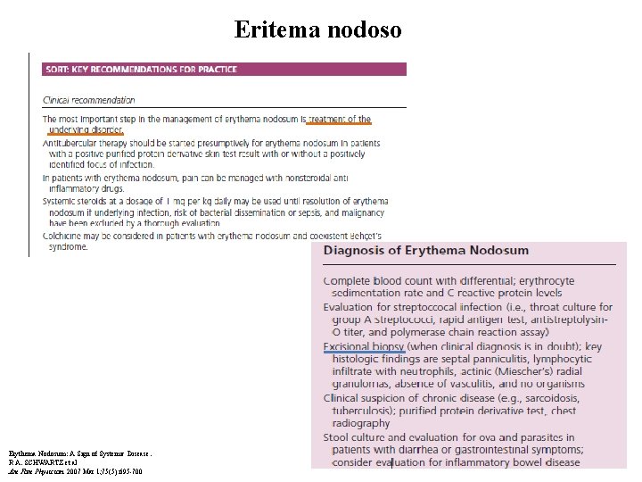 Eritema nodoso Erythema Nodosum: A Sign of Systemic Disease. R A. SCHWARTZ et al Eritema nodoso Erythema Nodosum: A Sign of Systemic Disease. R A. SCHWARTZ et al