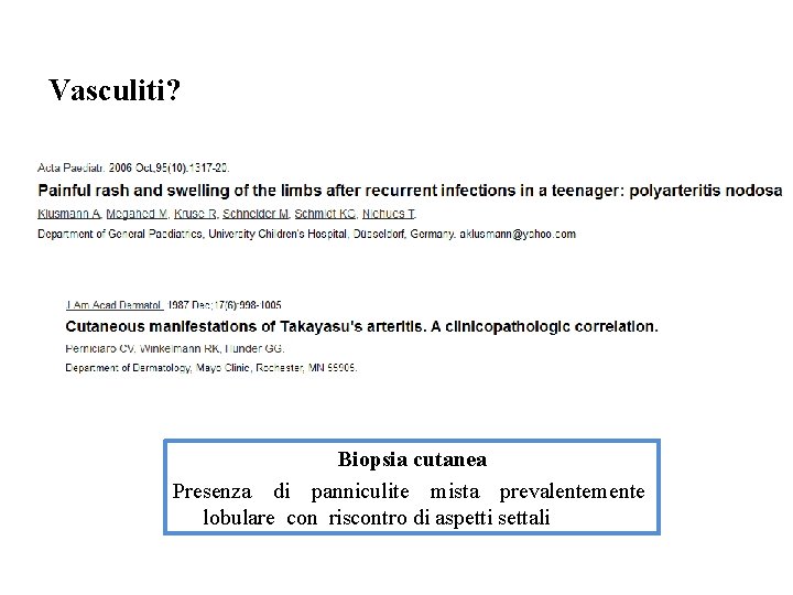 Vasculiti? Biopsia cutanea Presenza di panniculite mista prevalentemente lobulare con riscontro di aspetti settali Vasculiti? Biopsia cutanea Presenza di panniculite mista prevalentemente lobulare con riscontro di aspetti settali