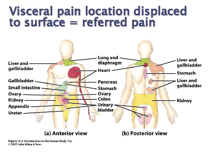 Visceral pain location displaced to surface = referred pain 