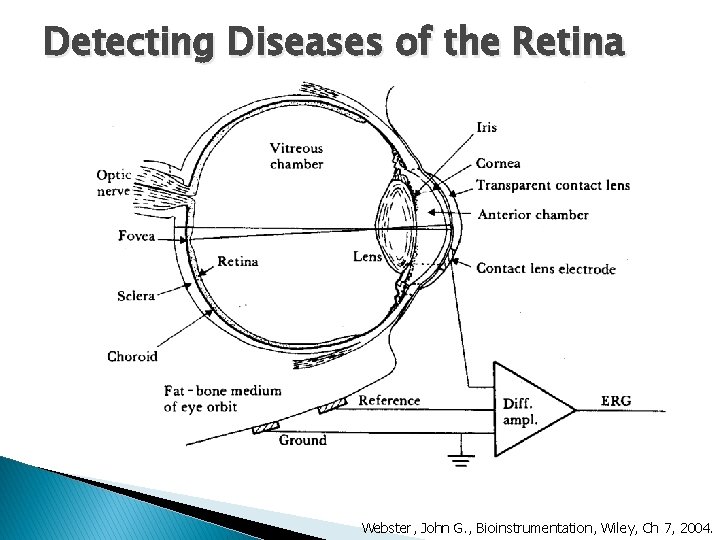 Detecting Diseases of the Retina Webster, John G. , Bioinstrumentation, Wiley, Ch 7, 2004.