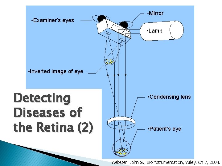  • Mirror • Examiner’s eyes • Lamp • Inverted image of eye Detecting