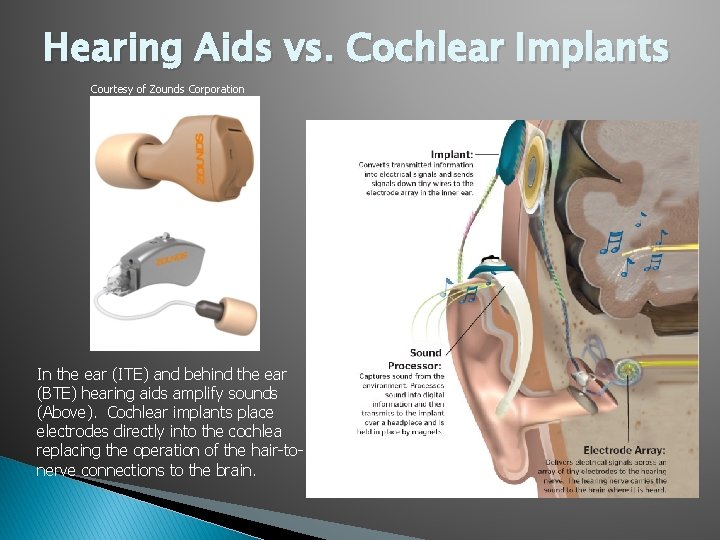 Hearing Aids vs. Cochlear Implants Courtesy of Zounds Corporation In the ear (ITE) and