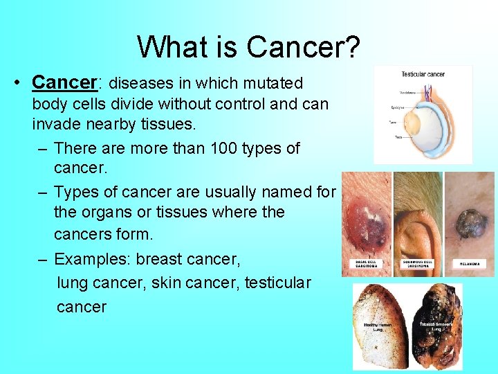 What is Cancer? • Cancer: diseases in which mutated body cells divide without control