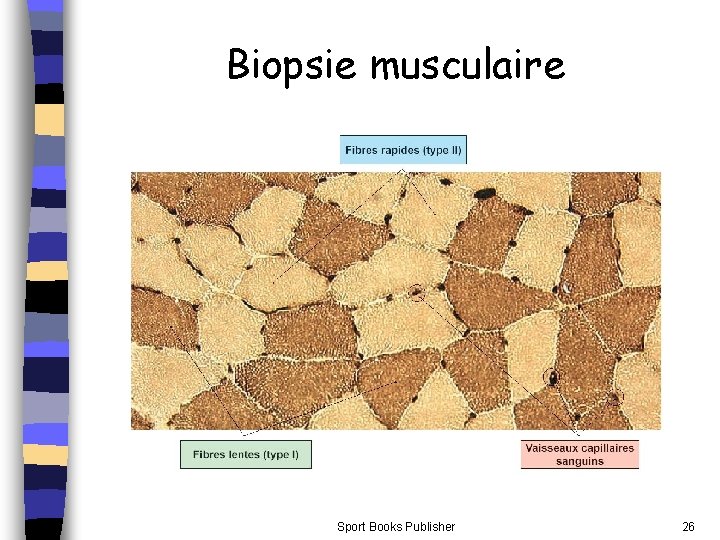 Biopsie musculaire Sport Books Publisher 26 