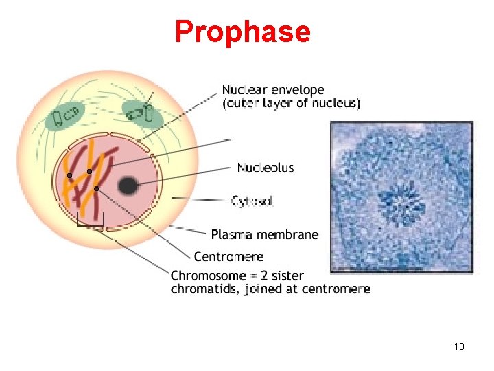 Prophase 18 