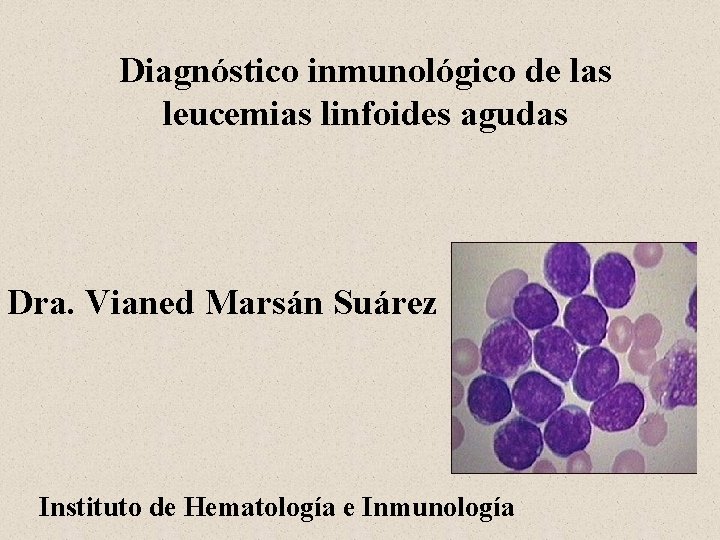 Diagnóstico inmunológico de las leucemias linfoides agudas Dra. Vianed Marsán Suárez Instituto de Hematología