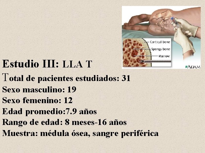 Estudio III: LLA T Total de pacientes estudiados: 31 Sexo masculino: 19 Sexo femenino: