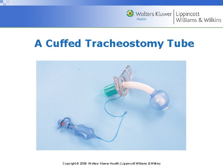 A Cuffed Tracheostomy Tube Copyright © 2009 Wolters Kluwer Health | Lippincott Williams &