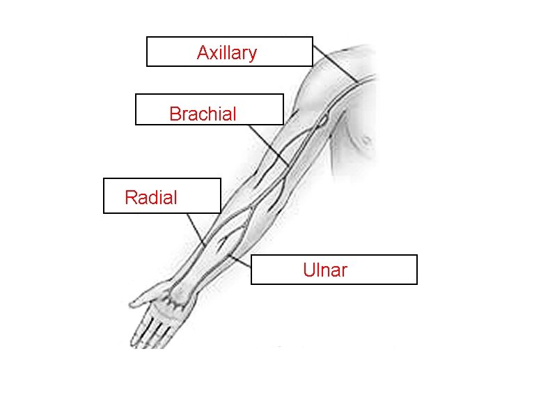 Axillary Brachial Radial Ulnar 