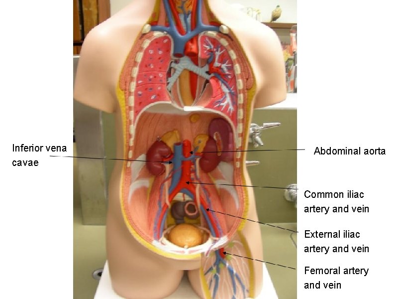 Inferior vena cavae Abdominal aorta Common iliac artery and vein External iliac artery and