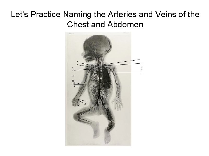 Let's Practice Naming the Arteries and Veins of the Chest and Abdomen 