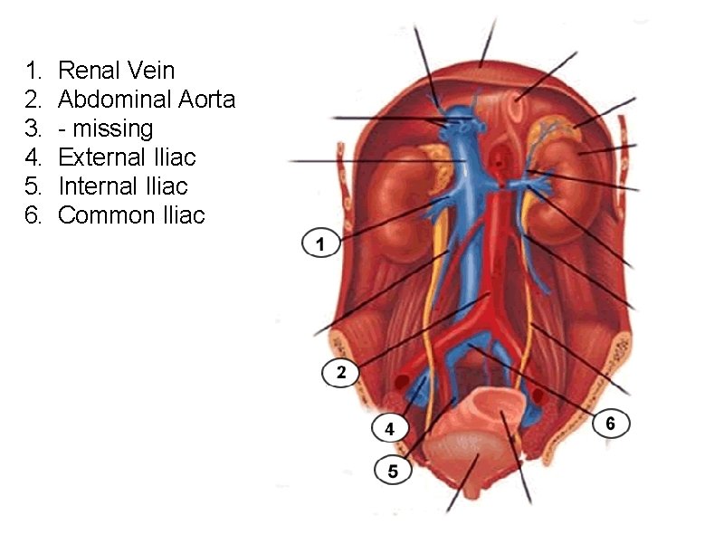 1. 2. 3. 4. 5. 6. Renal Vein Abdominal Aorta - missing External Iliac