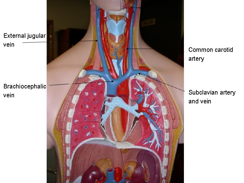 External jugular vein Brachiocephalic vein Common carotid artery Subclavian artery and vein 