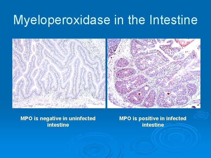 Myeloperoxidase in the Intestine MPO is negative in uninfected intestine MPO is positive in