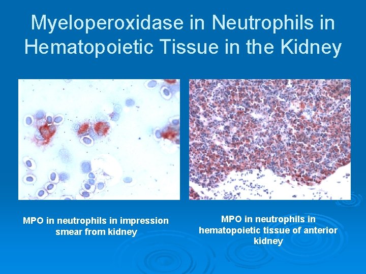Myeloperoxidase in Neutrophils in Hematopoietic Tissue in the Kidney MPO in neutrophils in impression
