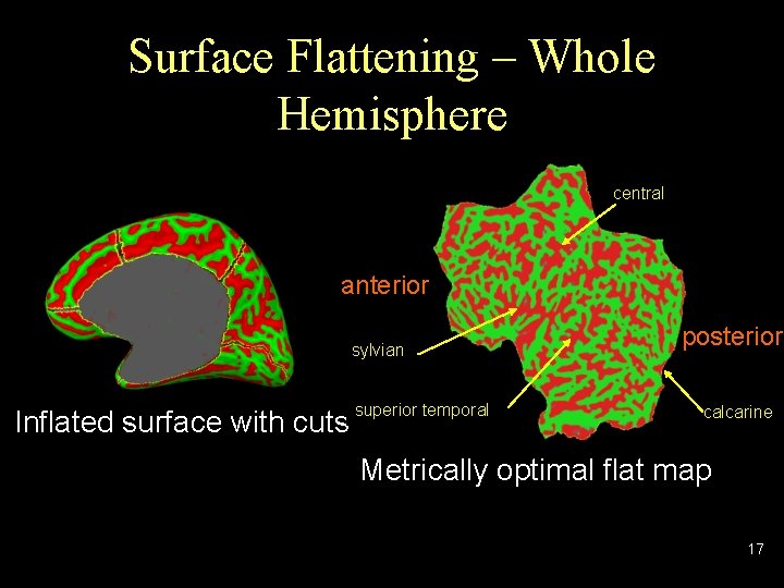 Surface Flattening – Whole Hemisphere central anterior sylvian Inflated surface with cuts superior temporal