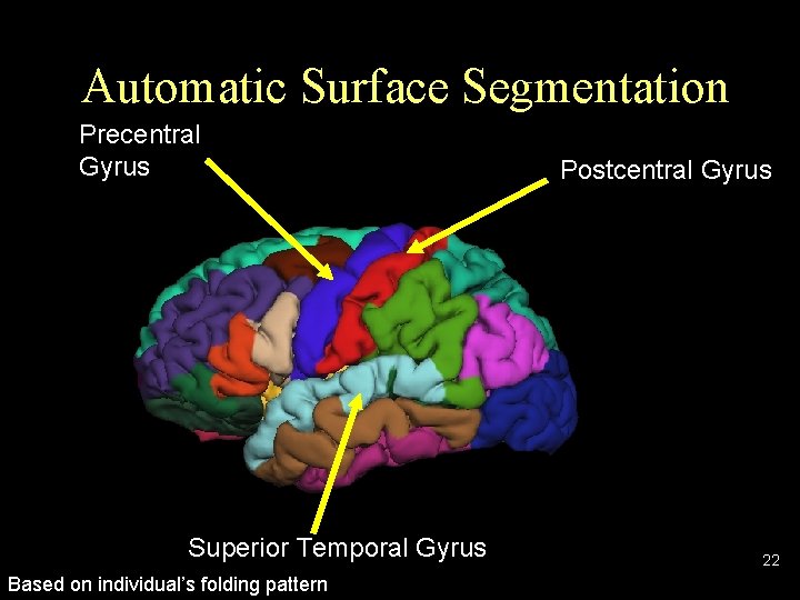 Automatic Surface Segmentation Precentral Gyrus Superior Temporal Gyrus Based on individual’s folding pattern Postcentral