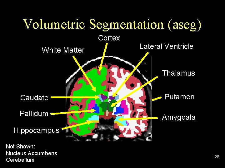 Volumetric Segmentation (aseg) Cortex White Matter Lateral Ventricle Thalamus Caudate Pallidum Putamen Amygdala Hippocampus