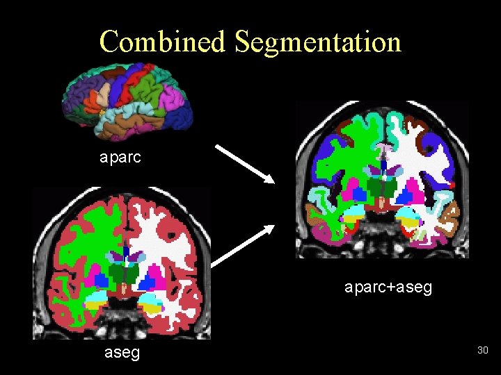 Combined Segmentation aparc+aseg 30 