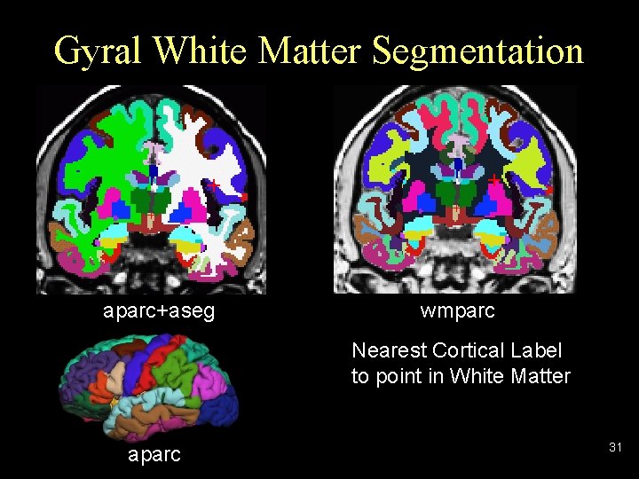 Gyral White Matter Segmentation + + aparc+aseg wmparc Nearest Cortical Label to point in