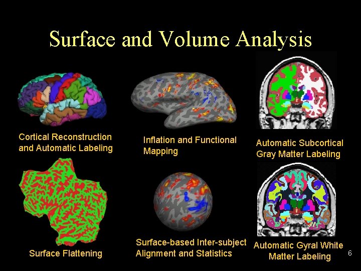 Surface and Volume Analysis Cortical Reconstruction and Automatic Labeling Surface Flattening Inflation and Functional