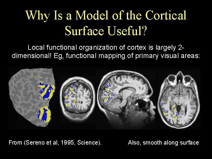 Why Is a Model of the Cortical Surface Useful? Local functional organization of cortex