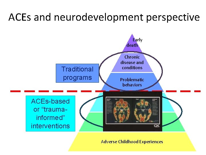 ACEs and neurodevelopment perspective Early death Traditional programs ACEs-based or “traumainformed” interventions Chronic disease