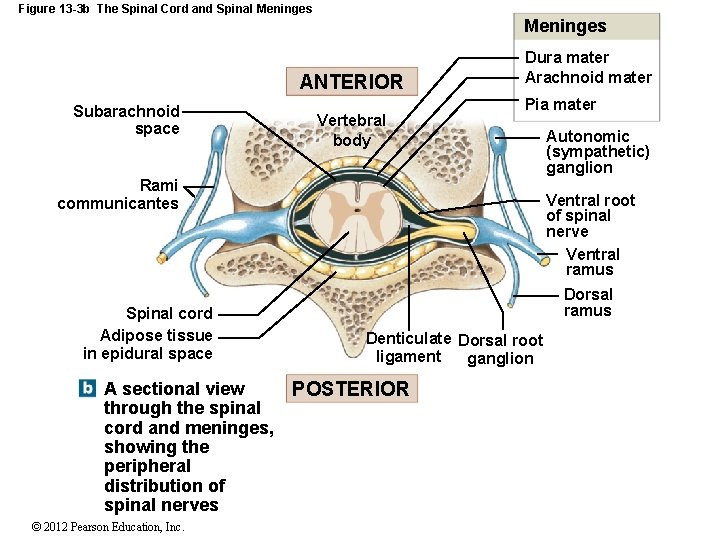 Figure 13 -3 b The Spinal Cord and Spinal Meninges ANTERIOR Subarachnoid space Vertebral Figure 13 -3 b The Spinal Cord and Spinal Meninges ANTERIOR Subarachnoid space Vertebral