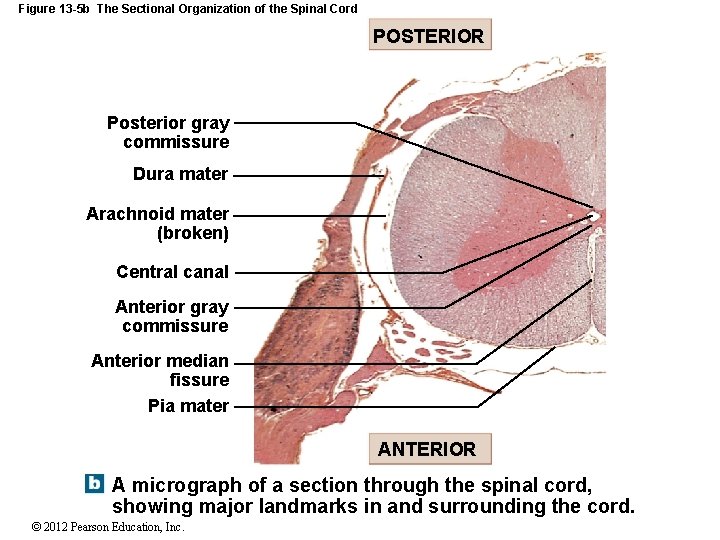 Figure 13 -5 b The Sectional Organization of the Spinal Cord POSTERIOR Posterior gray