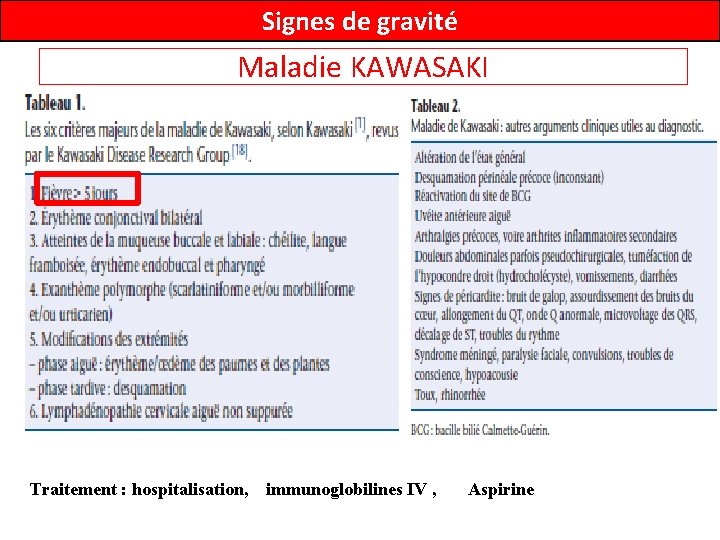 Signes de gravité Maladie KAWASAKI Traitement : hospitalisation, immunoglobilines IV , Aspirine 