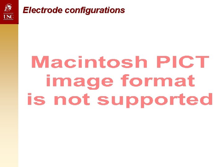 Electrode configurations Electrode configurations