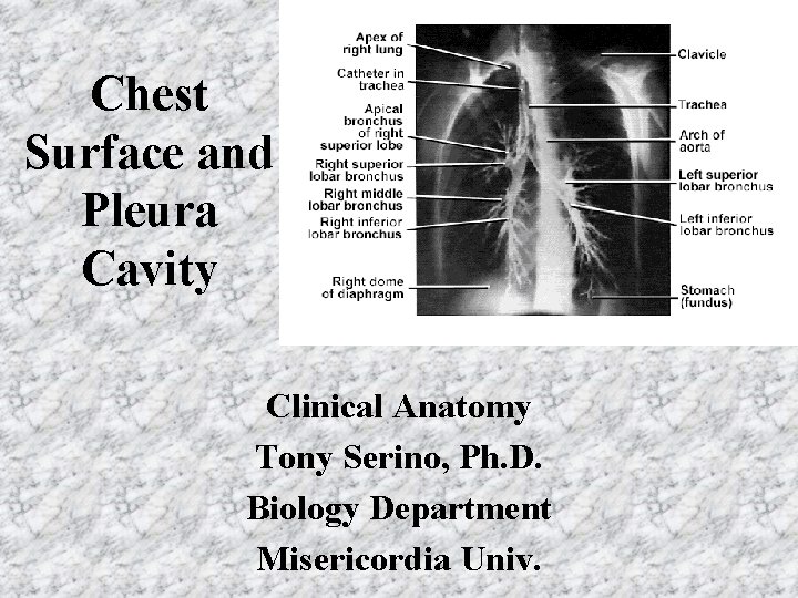 Chest Surface and Pleura Cavity Clinical Anatomy Tony Serino, Ph. D. Biology Department Misericordia Chest Surface and Pleura Cavity Clinical Anatomy Tony Serino, Ph. D. Biology Department Misericordia