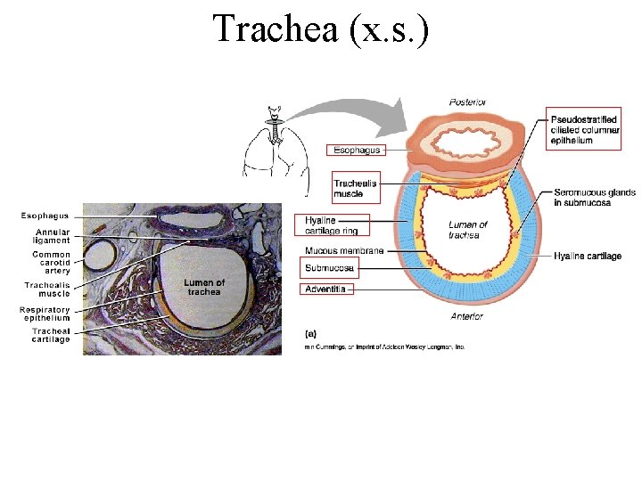 Trachea (x. s. ) Trachea (x. s. )