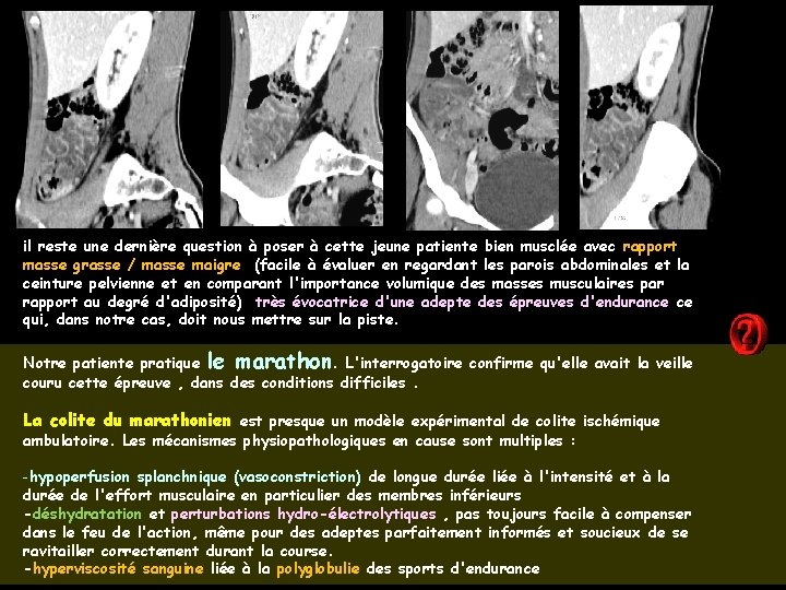 il reste une dernière question à poser à cette jeune patiente bien musclée avec