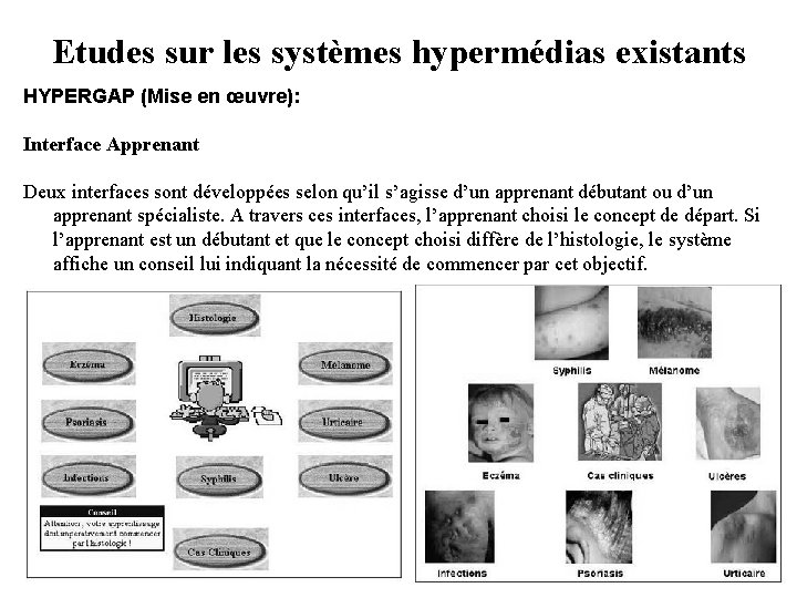 Etudes sur les systèmes hypermédias existants HYPERGAP (Mise en œuvre): Interface Apprenant Deux interfaces