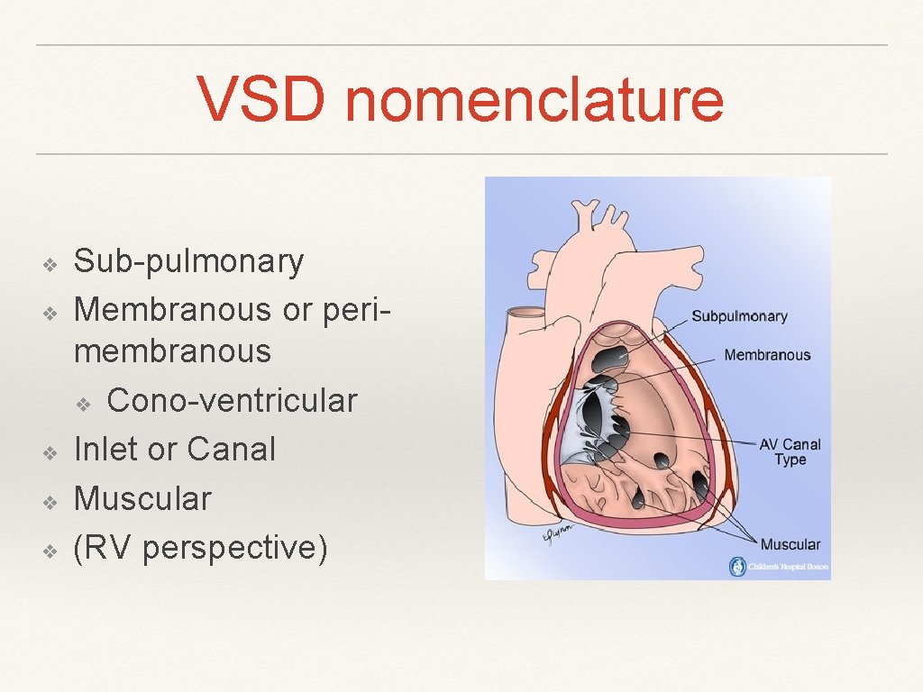 VSD nomenclature ❖ ❖ ❖ Sub-pulmonary Membranous or perimembranous ❖ Cono-ventricular Inlet or Canal VSD nomenclature ❖ ❖ ❖ Sub-pulmonary Membranous or perimembranous ❖ Cono-ventricular Inlet or Canal