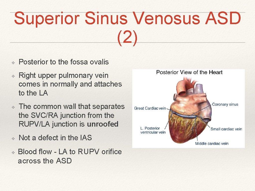 Superior Sinus Venosus ASD (2) ❖ ❖ ❖ Posterior to the fossa ovalis Right Superior Sinus Venosus ASD (2) ❖ ❖ ❖ Posterior to the fossa ovalis Right