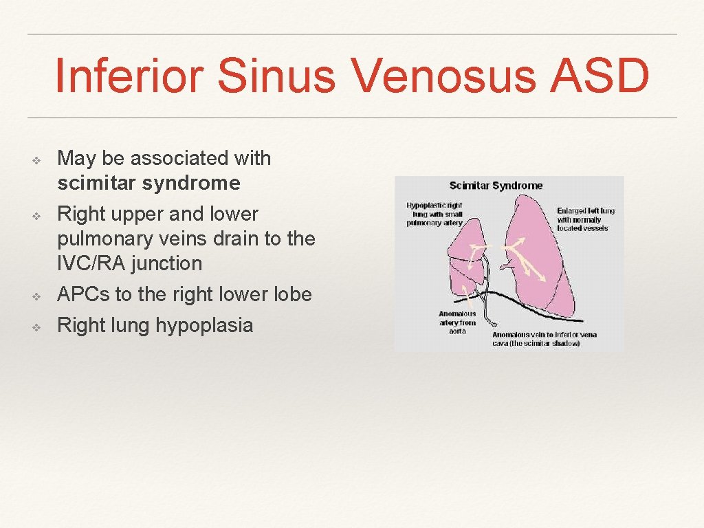 Inferior Sinus Venosus ASD ❖ ❖ May be associated with scimitar syndrome Right upper Inferior Sinus Venosus ASD ❖ ❖ May be associated with scimitar syndrome Right upper