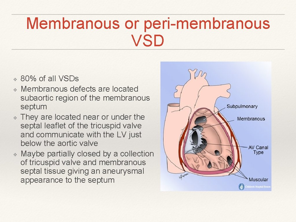 Membranous or peri-membranous VSD ❖ ❖ 80% of all VSDs Membranous defects are located Membranous or peri-membranous VSD ❖ ❖ 80% of all VSDs Membranous defects are located