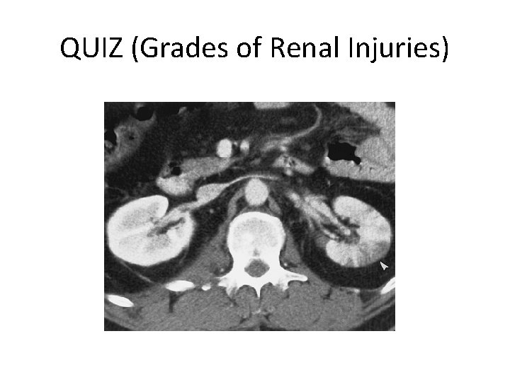 QUIZ (Grades of Renal Injuries) 