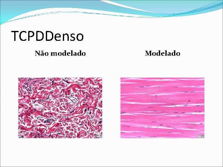 TCPDDenso Não modelado Modelado 