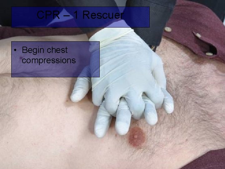 CPR – 1 Rescuer • Begin chest compressions 