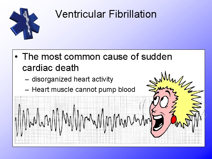 Ventricular Fibrillation • The most common cause of sudden cardiac death – disorganized heart