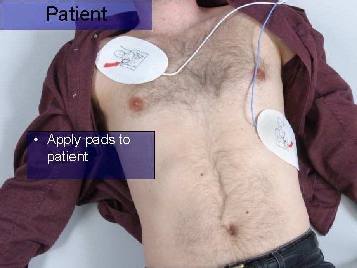 Patient • Apply pads to patient 