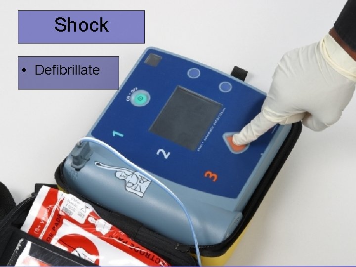 Shock • Defibrillate 