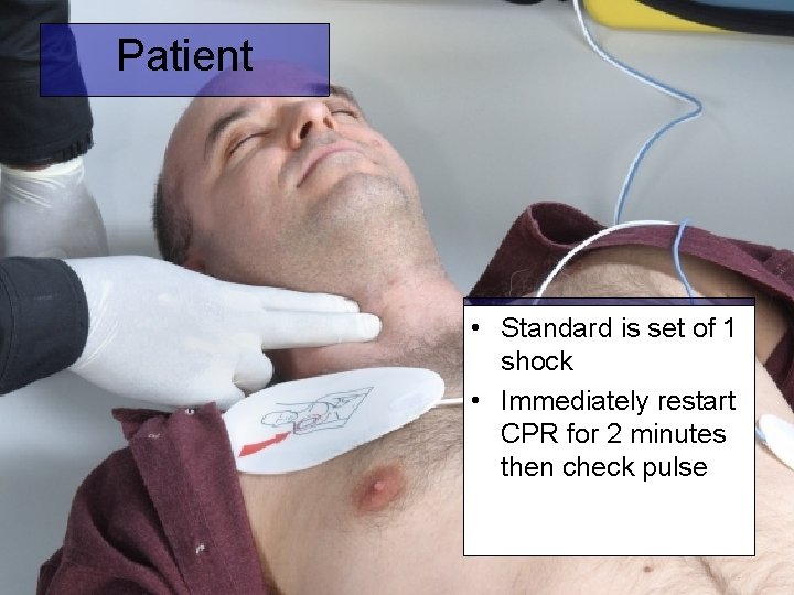 Patient • Standard is set of 1 shock • Immediately restart CPR for 2
