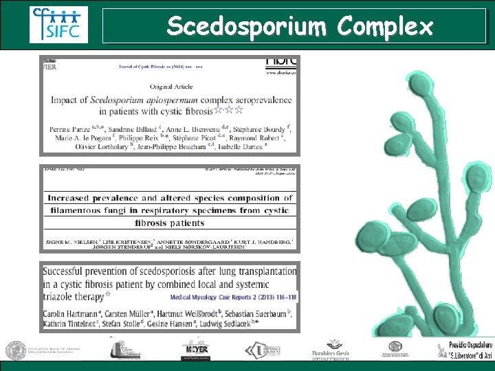 Scedosporium Complex 