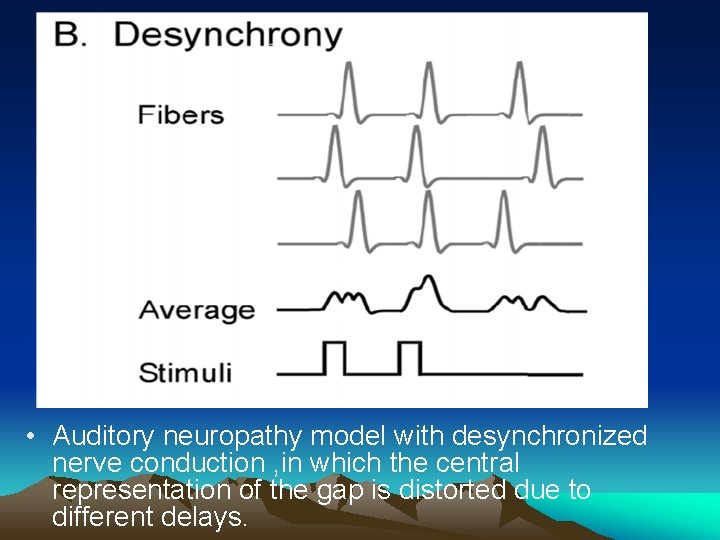  • Auditory neuropathy model with desynchronized nerve conduction , in which the central
